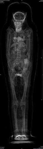 Yaplan taramalar M.. 900 civarnda Msrllarn sal ve davranlar konusunda nemli ipular verdi.