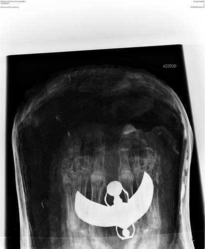 ngiltere'de Dr. Abeer Helmi, bu teknolojiyi kullanarak tarihin derinliklerinden gelen lahitleri aarken zarar verme riski olmadan ieriini grntleyebiliyor.