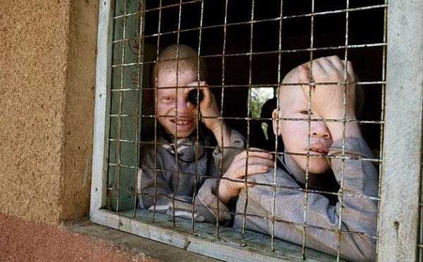 Albinolarn maruz kald bir dier iddet de tecavz. Zira Afrika&#8217;da bylerin yan sra bir albino ile cinsel ilikiye girmenin AIDS&#8217;i iyiletirdiine dair de bir inan var.