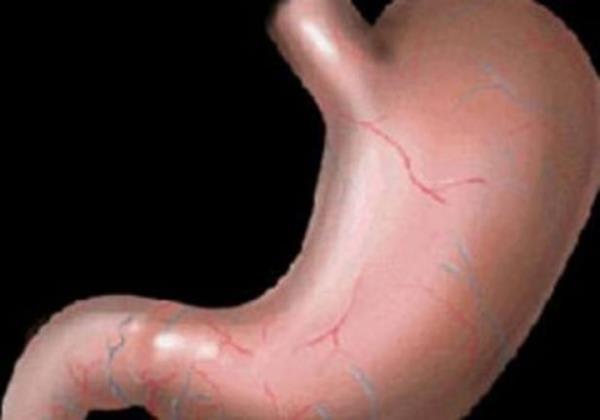 nsan midesi 2 haftada bir i zarn yenilemek zorundadr aksi halde kendi kendini sindirir.
