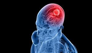 Dnsenize, dncelerinizi okuyup hibir aktivitede bulunmadnz halde kapnza devlet grevlilerinin gelip &#8220;Bilimsel lmler sebebiyle dncelerinizde X ahsna nefretinizin hat safhaya kt tespit edilmi, zarar verebileceiniz dnlerek tutuklama karar alnmtr&#8221; dediini. (Ho alete gerek duymadan bunu direkt uygulayan anlaylar da var ama...)