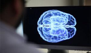 zellikle son 5 yldr bilim dnyasnda btn aratrma gruplar maddi skntdan kvranrken &#8220;nroteknoloji&#8221; ekipleri bu sknty hemen hemen hi yaamad. Nobel Tp dl alan MIT nrologlarndan Dr. Susumu Tonegawa, geen sene alnan paralarla gelitirilen tekniklerle neler yaplabileceini yle zetlemiti: