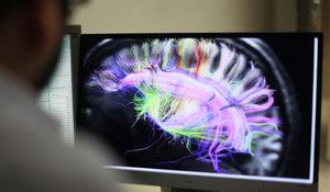 Oysa Amerika Savunma Bakanl 10 yl nce dnce okuma teknolojisinin lke gvenliinde kullanlmak amacyla daha ok zerinde allmas gerektiini vurgulamt. Hatta ilk denemeler havaalanlarnda terrle mcadele amacyla gvenlik kontrolnden geerken yolcularda beyin dalgalarnn okunmasyla kullanma bile srlmt.