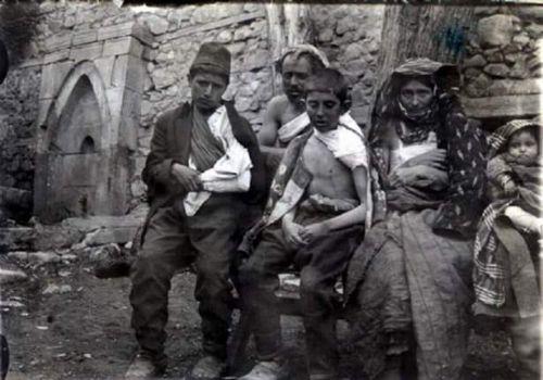 I. Dnya Savandaki Kafkasya Cephesi atmalar esnasnda yaral mslman mlteciler, Hasankale, 1915