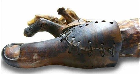 Tarihin ilk protezi olabileceği öne sürülen ve M.Ö 950-710 yıllarına ait olduğu düşünülen parmaklar, kadın bir mumyanın mezarında bulundu.