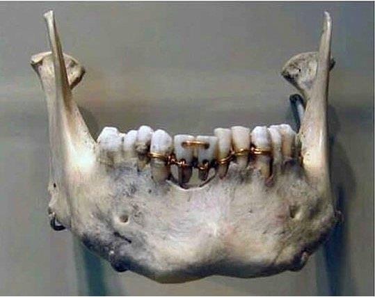 Milattan önce 2000 yılından kalma dünyanın en eski diş hekimliği çalışması
