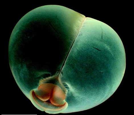 Pigbutt solucan  <br>Bu havyann domuz poposunu andran ekli sebebiyle ismi 'Pigbutt' konulmutur. Okyanus yzeyinin yaklak 1 km altnda yaarlar.