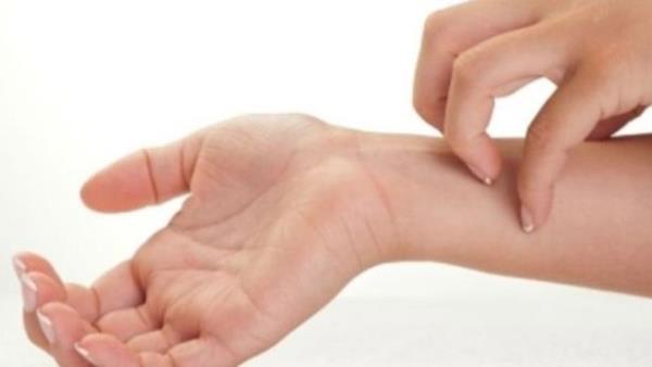 Kanmaktan korkma (akarofobi)