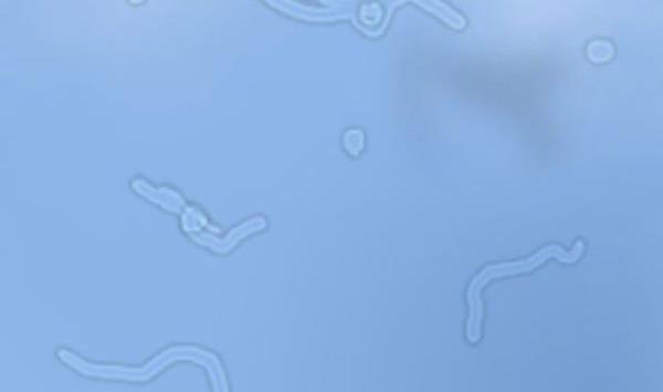 Zaman zaman gzmzn nnde oluan ufak ekiller (takip de edilebilen), gzn vitrz svsndaki proteinlerin yansmasdr.