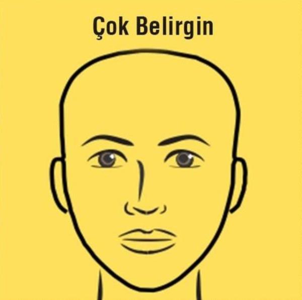 ok Belirgin Aln: Hayal gcnn ok youn olduunu gsterir.