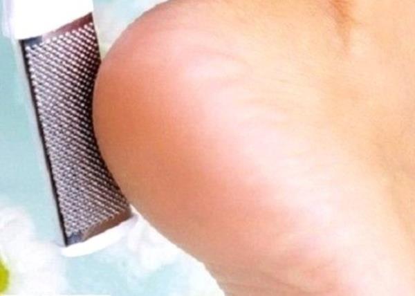 Topuklarnz sertleiyorsa&#8230; Ayaklarnza bir su iesi ile iki- dakika boyunca masaj yapn. Bu ilem sayesinde ayak tabannzdaki ukur blge gerilir ve topuunuzun dzlemesini engellemi olursunuz.