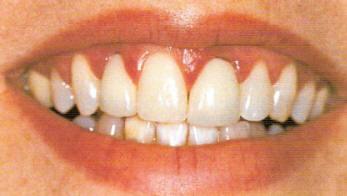 Ramazan&#8217;daki az kokusunun sebebi sadece uzun saatler bir ey yiyip iilmemesi deildir. Di eti rahatszl, rk, aza uygun yaplmam protez, boaz ve mide rahatszlklarnn da az kokusu yapt bilinmeli ve gerekli nlemler alnmaldr.