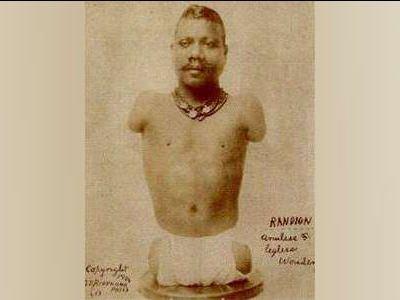 9. yzylda "Nurembergi'li Minik Adam" olarak nlenen Matthew Birchinger adl bir adam, tulum dahil drt mzik aletini kusursuz alabiliyor, mkemmel biimde hattatlk yapyor ve bugn bile kimsenin aklayamad sihirbazlk numaralar gerekletiriyordu.  "Ne var bunda" demeyin, nk Birchinger&#8217;in kollar ve belden aas yoktu ve boyu sadece 73 cm'di.