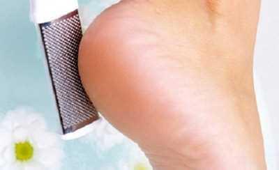 Topuklarnz sertleiyorsa&#8230; <br>Ayaklarnza bir su iesi ile iki- dakika boyunca masaj yapn. Bu ilem sayesinde ayak tabannzdaki ukur blge gerilir ve topuunuzun dzlemesini engellemi olursunuz.