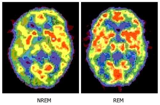 Uyurken beynimiz daha ok alyor<br>    nk beyinlerimiz, gn boyunca edinilen bilgileri ve hafzay dzenleme iini biz uyurken yapyor. Yani gn boyunca edinilen karmak veriler biz uyurken dzenleniyor. te bu yzden, uykusuz geen dnemlerde, hafzamz ok daha zayf alyor, rendiklerimizi ok abuk unutuyoruz ve anlarmz hafzada kolay kolay yer edemiyor.
