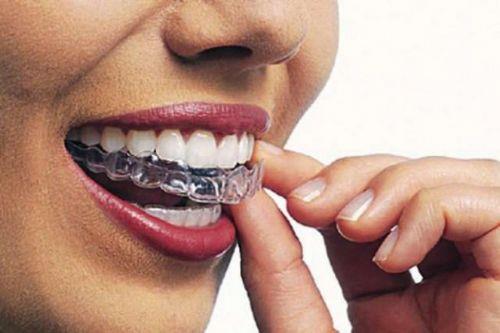 Takma damak ve di tellerinin dzenli olarak temizlenmesi arttr.