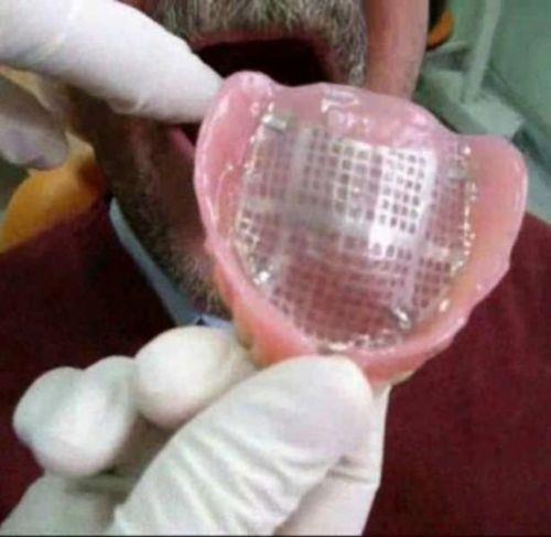 Takma diler ve azdaki yapsal bozukluklar iin kullanlan protez damaklar da bakteri yuvasdr.