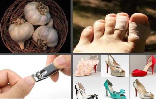 6- Rize'de cuma akam sarmsak yemek iyi deildir. Geceleri trnak kesilmez. Kesilen trnaklar bir kada sarlmal ve "Kyamet Gn'nde gelip beni bulun" diyerek bir delie sokulmaldr. Ayanda yaras olan kadn nce komu evine getirilir, iyilemesi iin dier kadnlar okuyup flerler sonrada yaral aya dikenle izerler. Yeni alnan ayakkablar aramba gn giyildiinde, abuk ypranaca inanc da yaygndr. Ayrca l birini borlu yatrmak gnahtr.