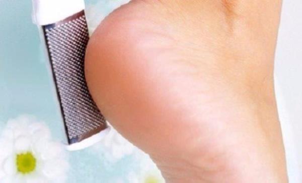 Topuklarnz sertleiyorsa&#8230;  <br>Ayaklarnza bir su iesi ile iki- dakika boyunca masaj yapn. Bu ilem sayesinde ayak tabannzdaki ukur blge gerilir ve topuunuzun dzlemesini engellemi olursunuz.