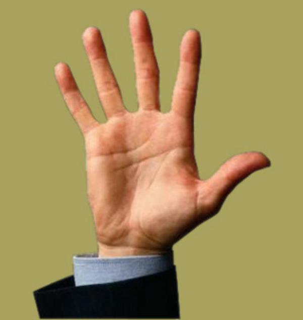 Bu tip eklem yerlerinde, rnein parmaklarmzda, iki kemiin birletii yerde bir balant kapsl vardr.