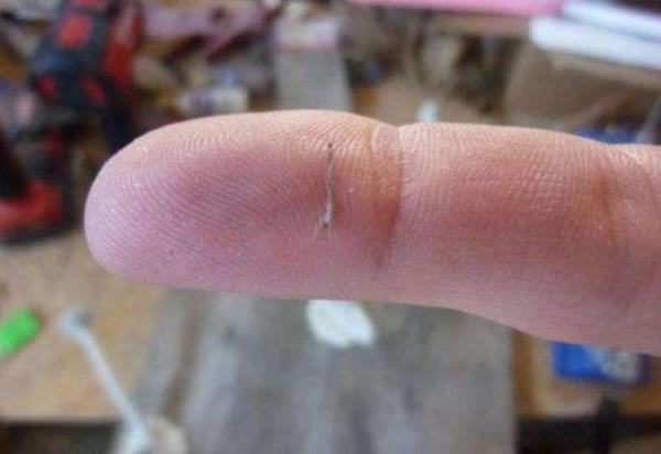 Kymn zerine bir dilim sarmsa yerletirin ve parmanz bandajla sarn.