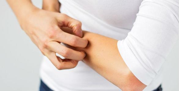 Kanmaktan korkma (akarofobi)