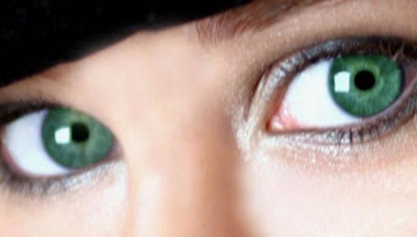 Suni irisleri imal eden BrightOcular, istendiinde nakledilen parann kolayca karlabildiini bildirdi.