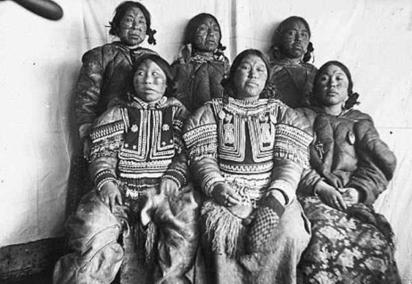 Eskimo bebekleri nezle olduunda anneleri burunlarndaki sm emerek temizler