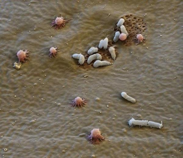 Atmosferik basncn 1200 kat kadar yksek basnlarda da canlln kaybetmez.