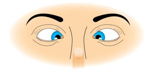 Sa kolunu karya doru dik tutarak, ba parmana odaklanarak bak Yava yava burnuna doru yaklatr ki gznn tam ortasna kadar getir Tekrar yava yava uzaklatr