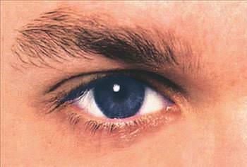 Erkeklerin gz farkl klar daha kolay seiyor.