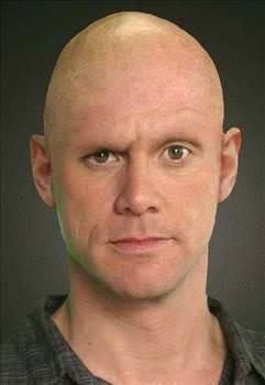 Erkekler, erkeklik hormonu testerojen yznden kel kalyor. Kadnlarda dklen salarn yerine yenileri daha kolay kyor.