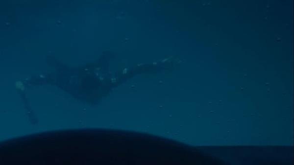 Bir sre sonra elinde zpknla gelen adam inanlmaz bir hamle daha yapar...