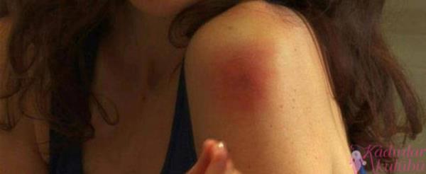 Yine ABD kaynakl bir aratrmaya gre, sivrisinekler, dolunay zamannda, dier zamanlarda olduklarndan 500 kat daha hareketli oluyor.