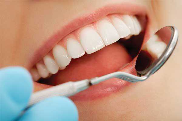 Di beyazlatclar doktor kontrolnde kullanlmal