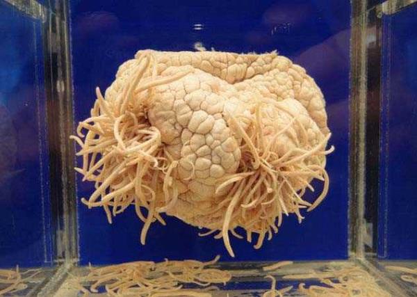 Barsak solucan Bu solucanlar yutan insanlar beslendikleriyle beslenen barsak solucanlar sayesinde zayf kalyorlar. Bu riskli hareketin sonucunda da kiinin sindirim sistemi, i organlarnn ilevleri, beyni zarar grebiliyor hatta kiinin lmne bile sebep olabiliyor.