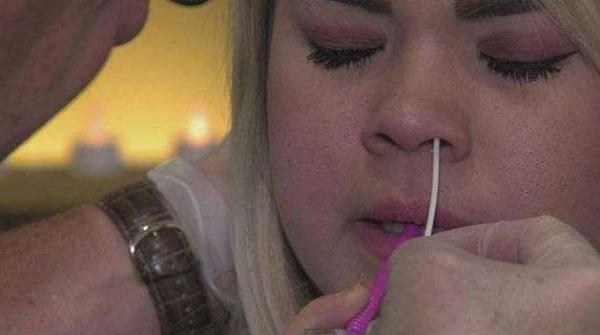 Tp yoluyla beslenmek Baz kadnlar kilo vermek uruna burunlarndan ieriye beslenme sondas yerletirtiyorlar ve 10 gn / 24 saat boyunca bu sondayla yayorlar.