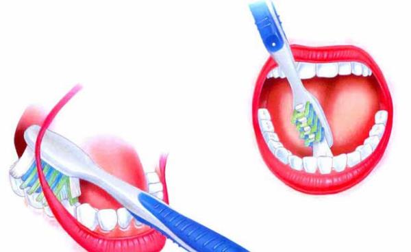 Dilerin  Blgesini Fralamamak<br>ou insan dilerinin arka blmlerini, dillerinin en ok temas ettii bu yzeyleri fralamay unutur yada hi fralamaz. Ancak  grnmeyen plaklar temizlemek, grnen plaklar temizlemek kadar nemlidir. Doktorlara gre en ok es  geilen blge alt dilerimizin arkasdr. Siz siz olun di fralarken bu blgeleri unutmayn.