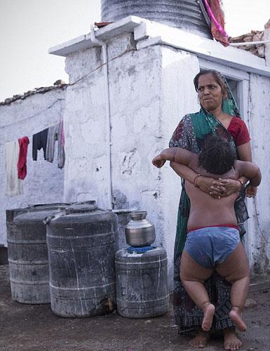 Baba Rameshbhai Nandwana, "Onlarn tedavi olmas iin bbreimi satmay dnyorum. Srekli yemek istiyorlar, eer verilmezse alayp lk atyorlar. Byle giderlerse leceklerden korkuyorum" dedi.