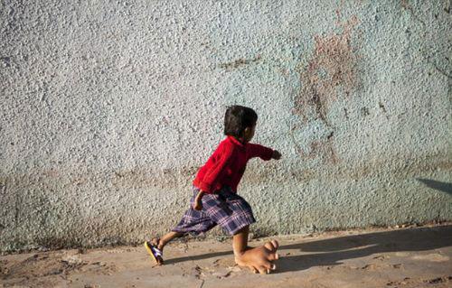 Birka kez kan, tkrk ve ter rnekleri alnp incelenmesine ramen herhangi bir tehis konulmadn belirten anne Jayshree, 4 yl iinde yzden fazla doktora gittiklerini syledi...