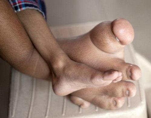 Baba Dilip evladnn sakat kalamsn asla istemediini ve bir tedavi yntemi bulana kadar araylarna devam edeceini belirtti.